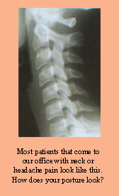 Most Patients That Come To Our Office With Neck Or Headache Pain Look Like This. How Does Your Posture Look?